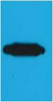 RFP-Tag Mouse mAb Antibody