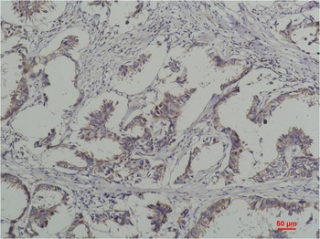 Phosphotyrosine Mouse mAb Antibody