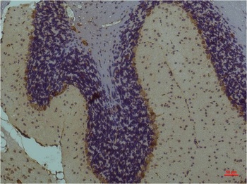 STAT3 Mouse mAb Antibody
