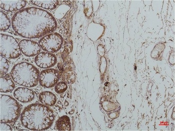 GRP78/Bip Mouse mAb Antibody