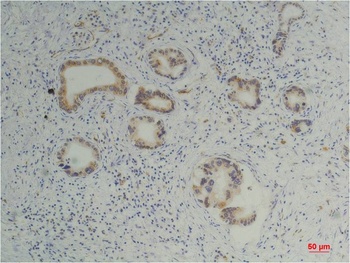 Cyclophilin B Mouse mAb Antibody