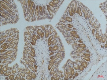 AMPK α1 Mouse mAb Antibody