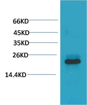 HSPB8/HSP22 Mouse mAb Antibody