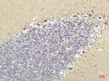 PPAR Delta (2F9) Mouse mAb Antibody