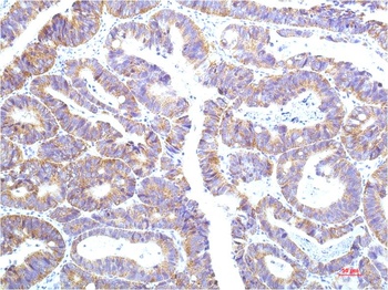 STAT1 (12E8) Mouse mAb Antibody