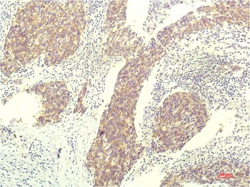 STAT1 (12E8) Mouse mAb Antibody