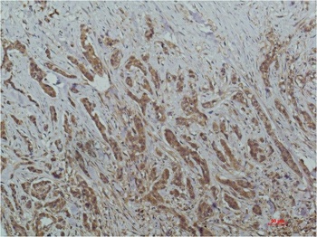 HDAC1 (4E1) Mouse mAb Antibody