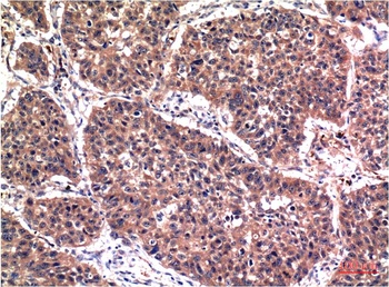Phospho-Akt (S473) (6F8) Mouse mAb Antibody
