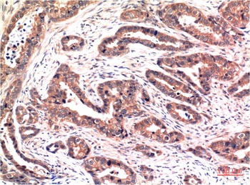 Phospho-Akt (S473) (6F8) Mouse mAb Antibody
