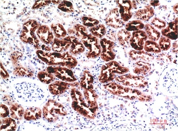 Cystatin C (7F11) Mouse mAb Antibody