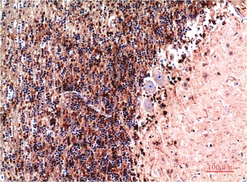 Cystatin C (7F11) Mouse mAb Antibody