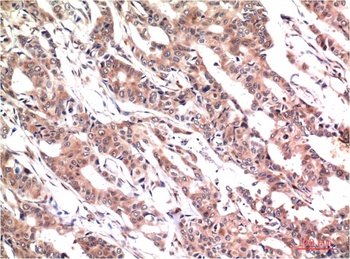 Phospho-Stat3 (Y705) (1E9) Mouse mAb Antibody