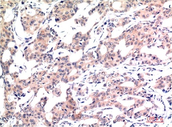 Acetyl-Histone H3 (K9) (2E7) Mouse mAb Antibody