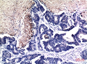 Acetyl-Histone H3 (K9) (2E7) Mouse mAb Antibody