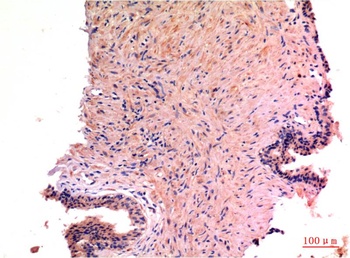 LC3A (5G10) Mouse mAb Antibody