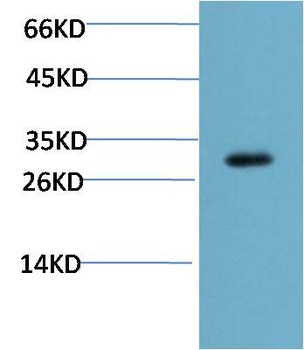 CHOP (2B1) Mouse mAb Antibody