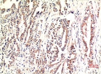 CHOP (2B1) Mouse mAb Antibody