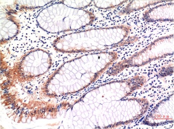 phospho-MLKL (S358) (6B4) Mouse mAb Antibody