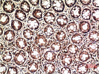 ERK1/2 (1H4) Mouse mAb Antibody