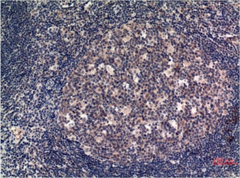 MLKL (8H7) Mouse mAb Antibody