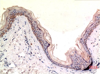 MLKL (8H7) Mouse mAb Antibody