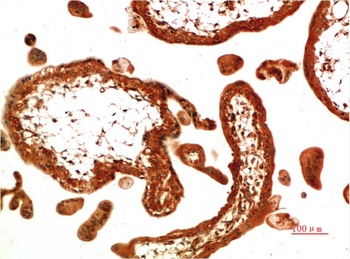 TGFβ1 (4B9) Mouse mAb Antibody