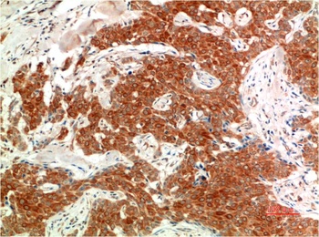 Phospho-ERK 1/2 (Y205/222) (7A6) Mouse mAb Antibody