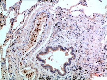 P38 (1G1) Mouse mAb Antibody