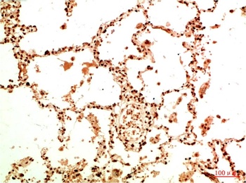 Acetyl NF kB P65（K314/K315) (5G11) Mouse mAb Antibody