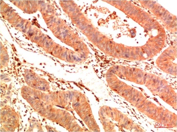 Acetyl P53(K382) (1G7) Mouse mAb Antibody