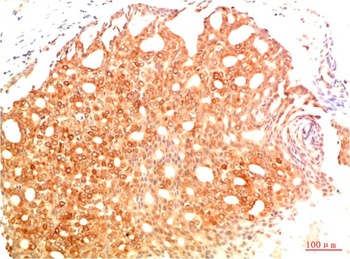 Acetyl P53(K382) (1G7) Mouse mAb Antibody