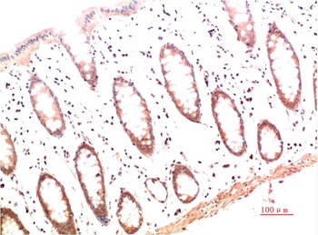 Collagen I (4B5) Mouse mAb Antibody
