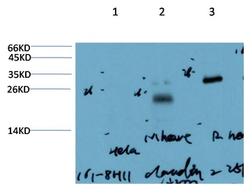 Claudin-2 (8H11) Mouse mAb Antibody