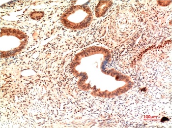 Claudin-2 (8H11) Mouse mAb Antibody