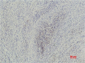 Histone H3(mono methyl K79) Mouse mAb Antibody