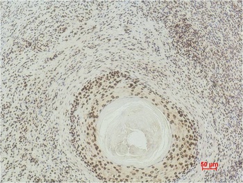 Histone H3(di methyl K27) Mouse mAb Antibody