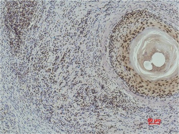 Histone H3(di methyl K9) Mouse mAb Antibody