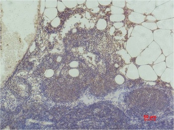 Histone H3(tri methyl K9) Mouse mAb Antibody