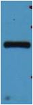 mStrawberry-Tag Rabbit pAb Antibody
