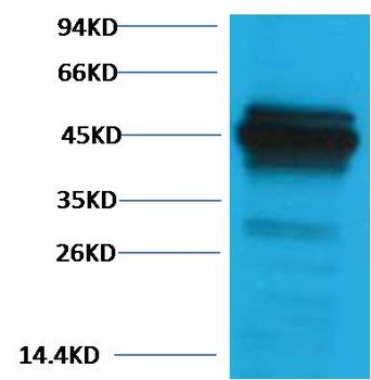 Cytokeratin 18 Rabbit pAb Antibody