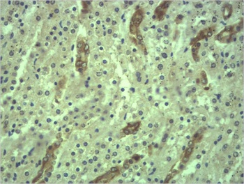 Cytokeratin 18 Rabbit pAb Antibody