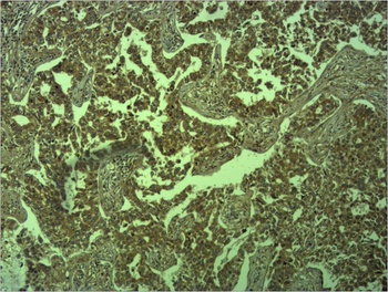 E-Cadherin Rabbit pAb Antibody
