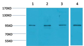 ERK3 Rabbit pAb Antibody