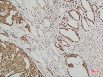 ERK3 Rabbit pAb Antibody