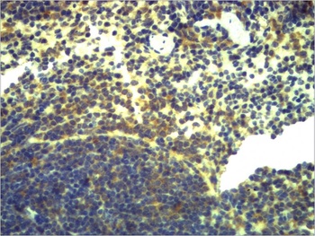 TLR2 Rabbit pAb Antibody