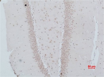 NMBR (Bombesin Receptor 1) Rabbit pAb Antibody