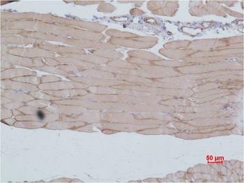 eEF1A2 binding protein Rabbit pAb Antibody