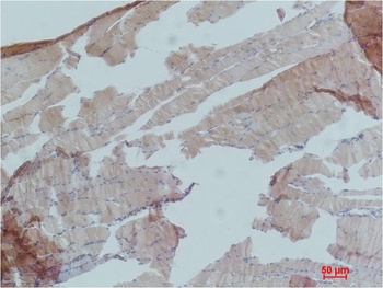 AMPKα1 Rabbit pAb Antibody