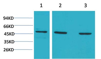 MEK5 Rabbit pAb Antibody