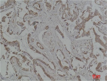 MEK5 Rabbit pAb Antibody